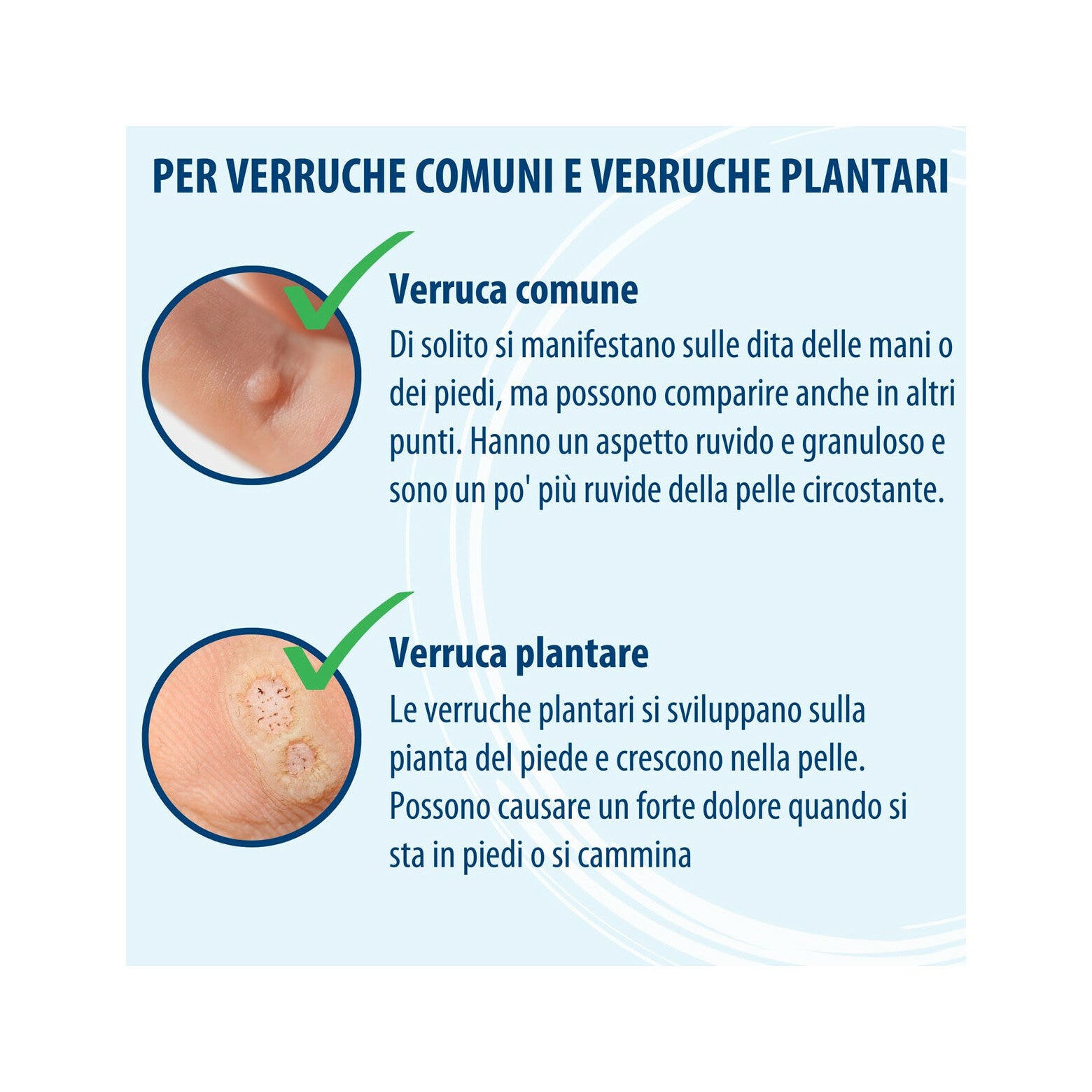 Evolsin Penna Antiverruca Contro Le Verruche Su Piedi, Mani, Corpo, Braccia & Gambe 3ml-3