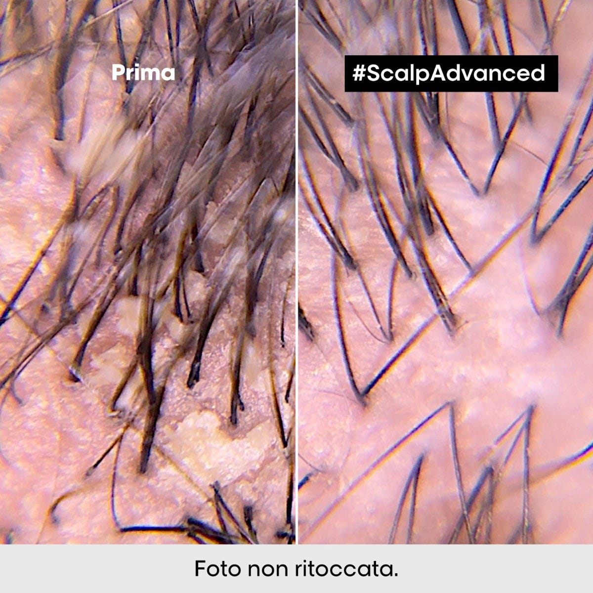 Scalp Advanced Shampoo Dermo-Clarifier