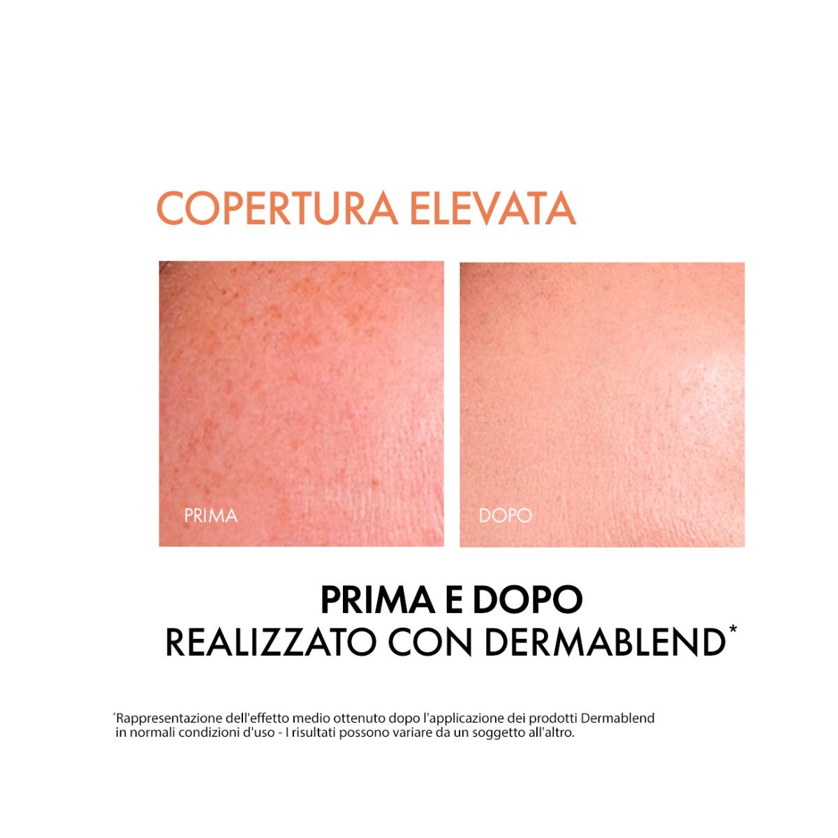 Vichy Dermablend Fondotinta Fluido Coprente Tonalità 45 30ml SPF35-10