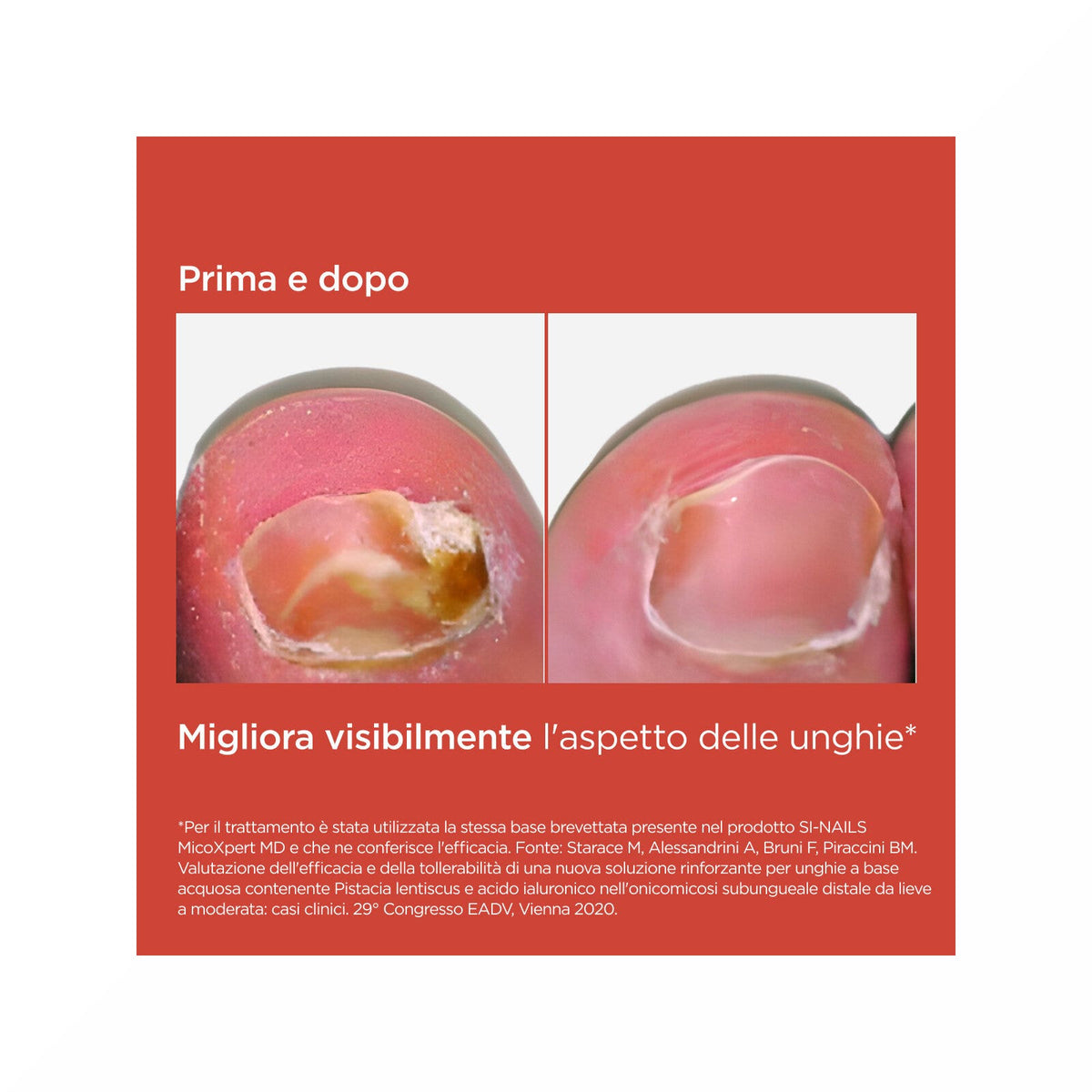 Isdin Si-Nails Micoxpert Md Trattamento Unghie Infezioni Fungine 4,5ml-5