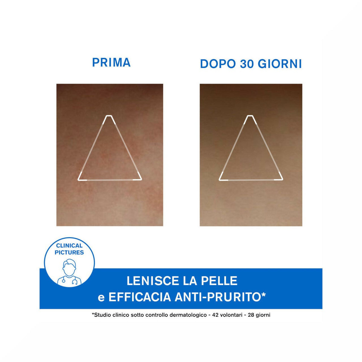 Uriage Xemose Cerato Anti-Irritazioni 200 ml-8