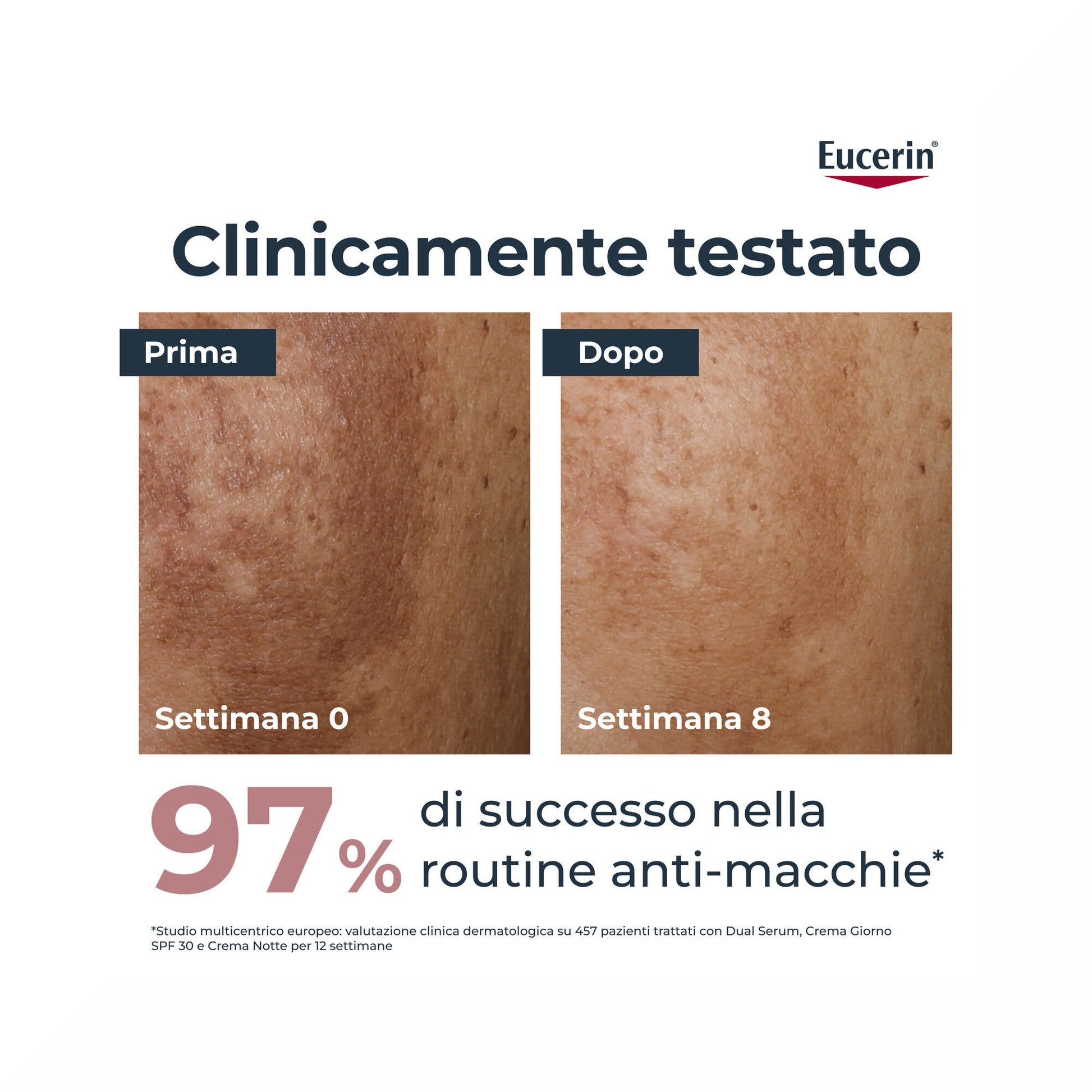Eucerin Anti-Pigment Dual Serum 30ml-3