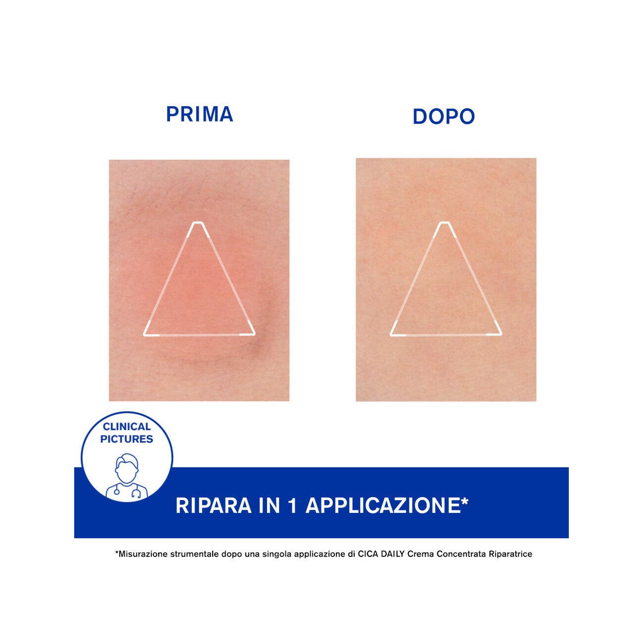 Uriage Cica Daily Crema Concentrata Riparatrice 50ml-10