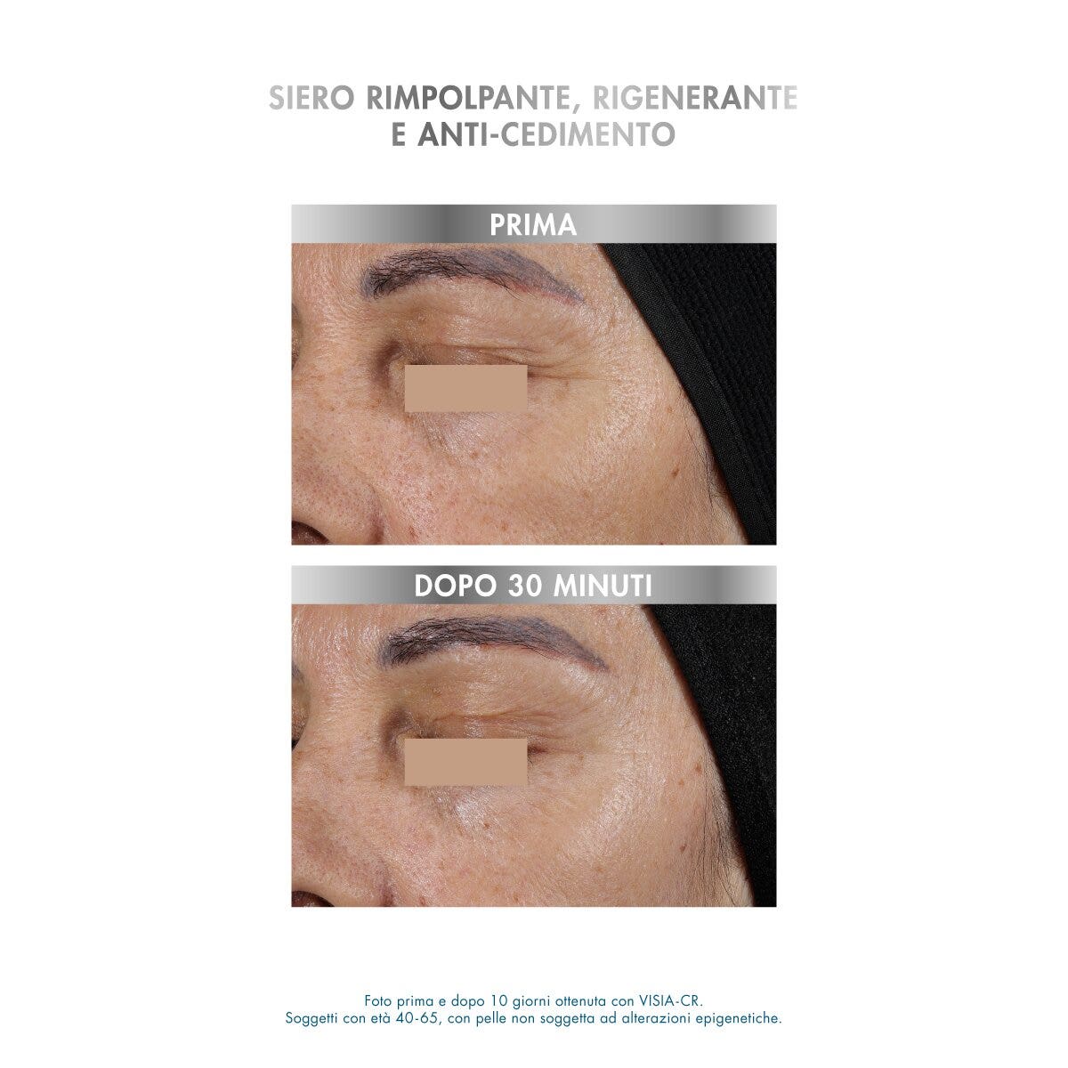 Miamo Epigenage Shot Epigenetic Formula 10 Siringhe Da 1ml-3