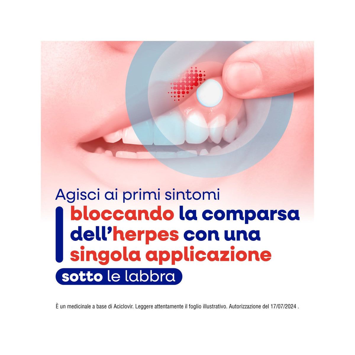 Herpmed Labiale 50mg 2 Compresse Buccali Mucoadesive-3